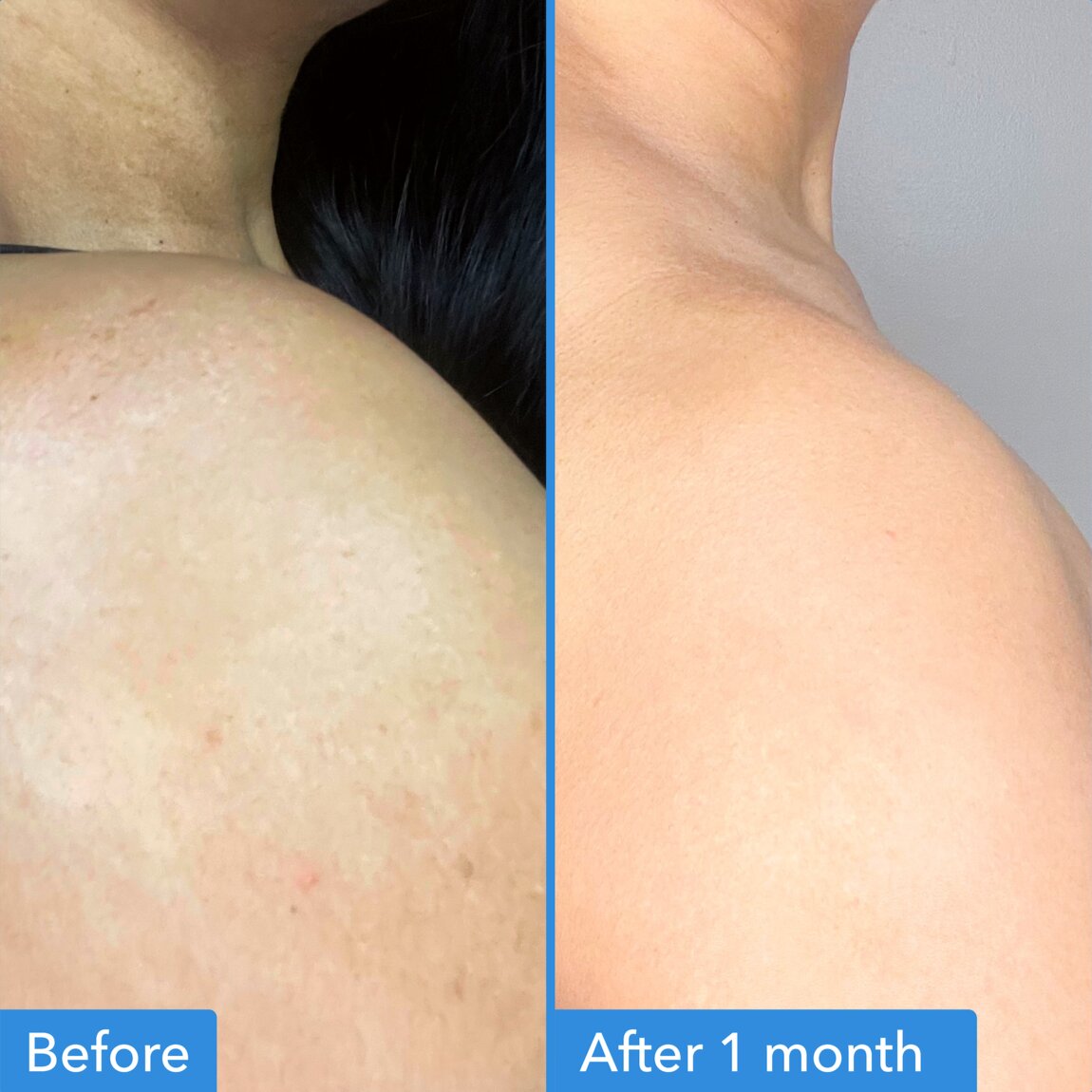 discoloration-correcting-body-treatment-d1 zb_p.jpg