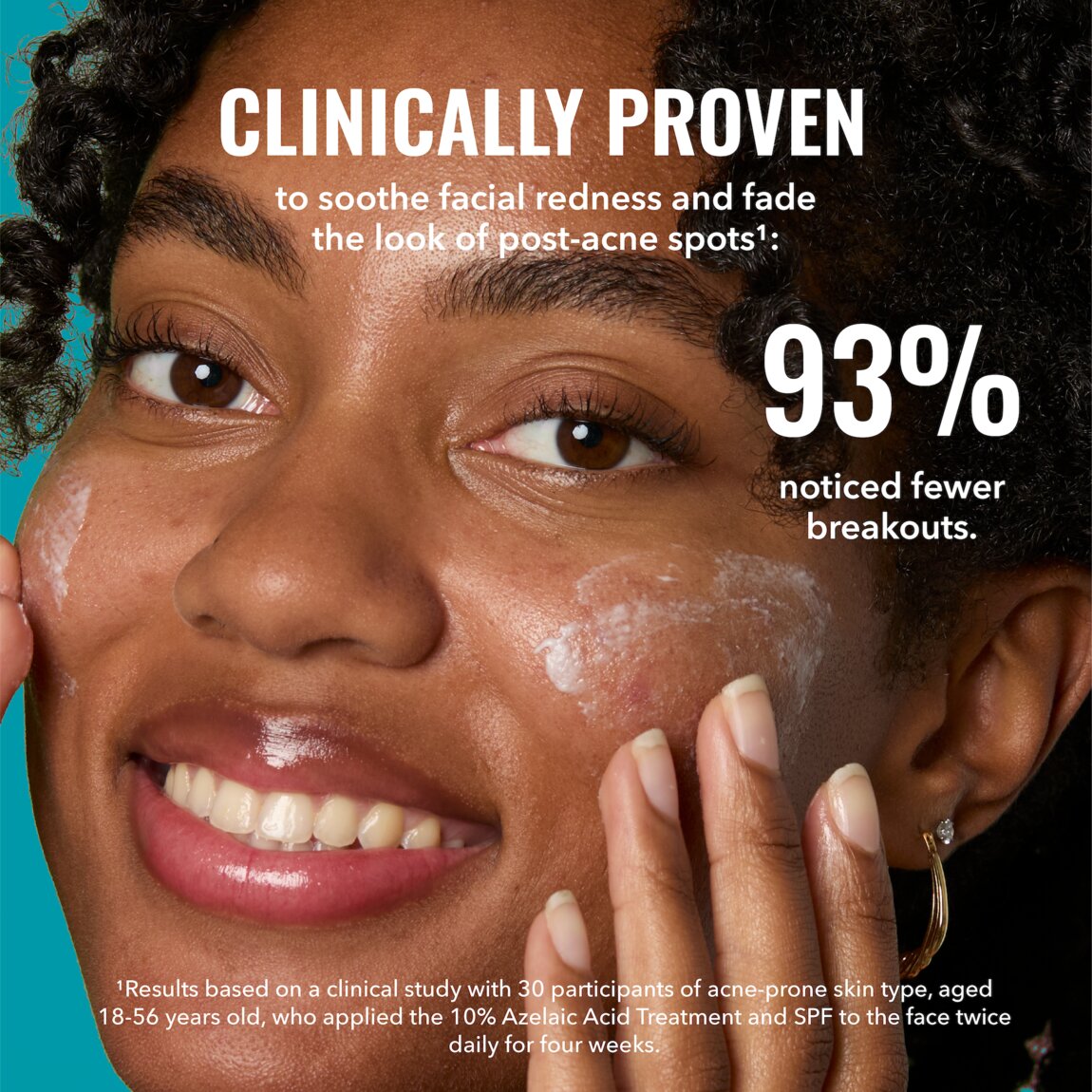 10-azelaic-acid-treatment-r8 zb_p.jpg