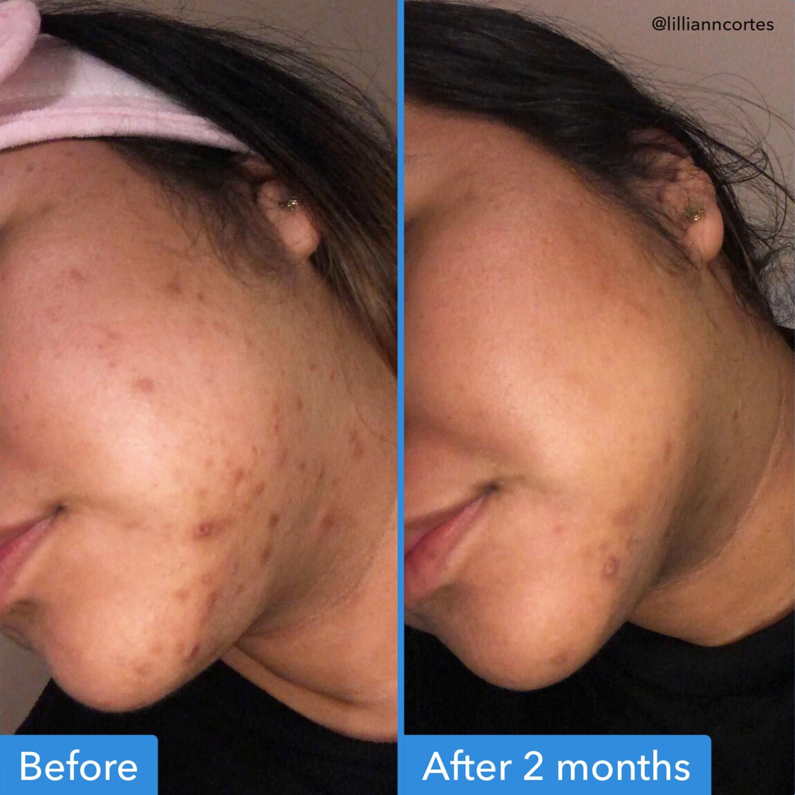 discoloration-correcting-serum-k9 zb_p.jpg