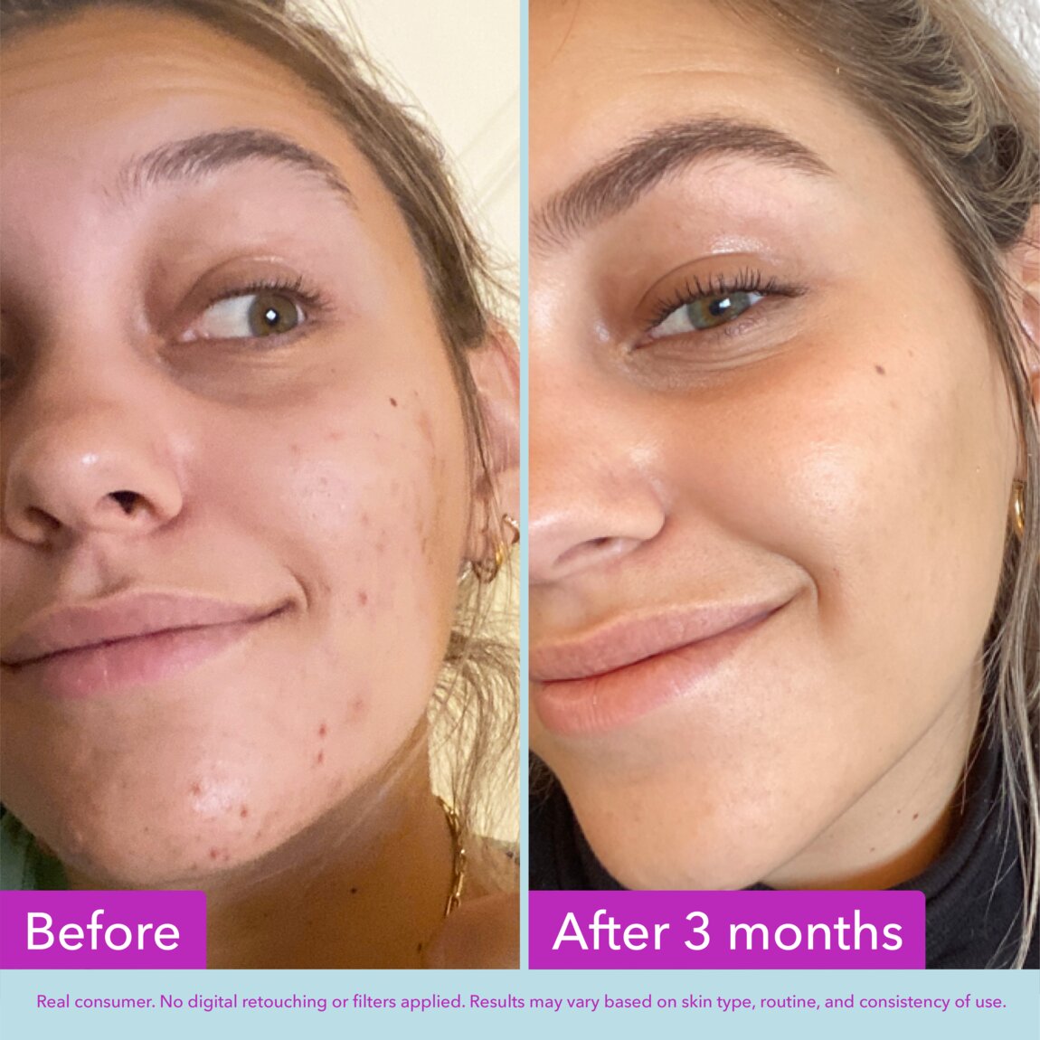 niacinamide-brightening-toner-w0 zb_p.jpg